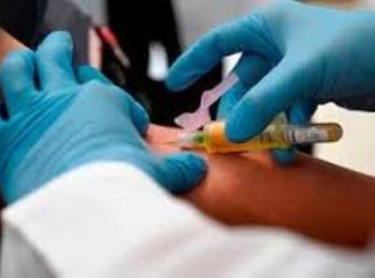 República Dominicana registra epidemia de VIH, según la OPS