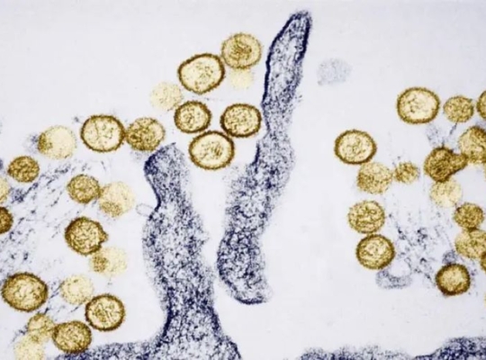 Qué es el hantavirus, la infección sospechosa de causar 3 muertes en un crucero que zarpó de Ushuaia (y cuán extendido está en Argentina)